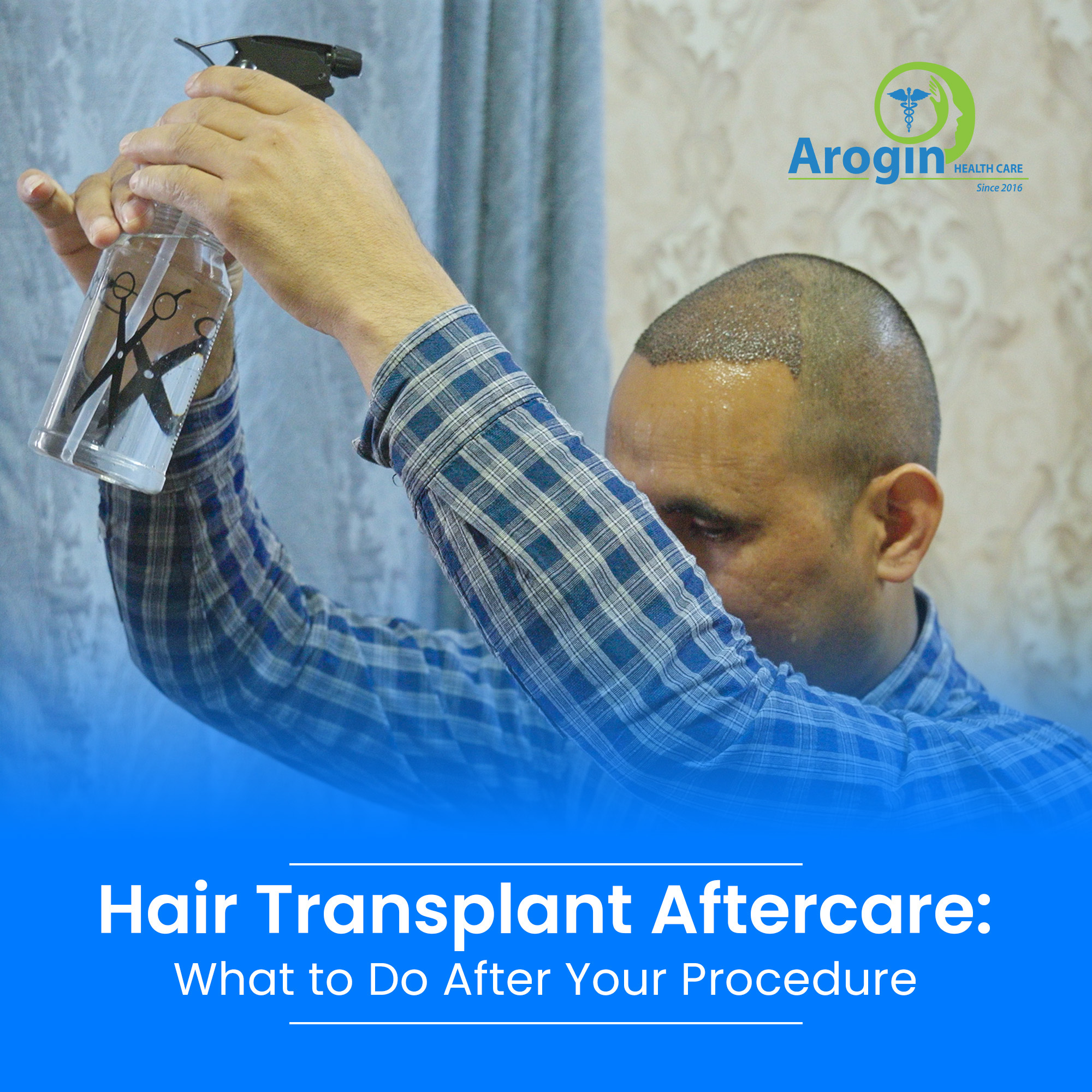 Hair Transplant Aftercare: What to Do After Your Procedure